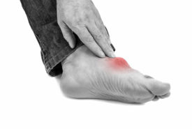 Immediate pain relief measures for gout