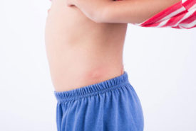 10 common types of skin rashes you should be aware of 