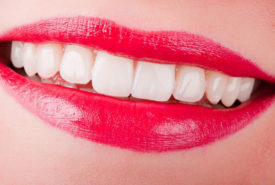 4 useful tips for sparkling pearly white teeth