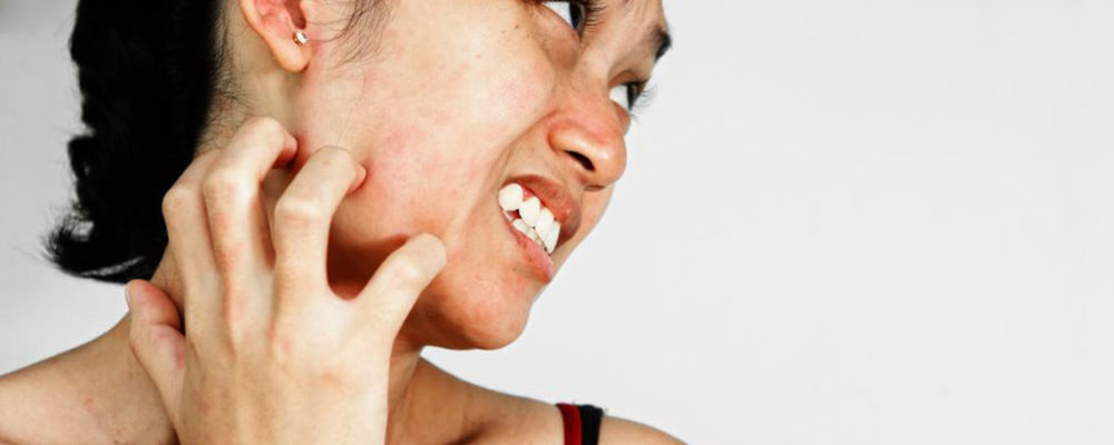 7 easy and useful ways to manage itchy skin