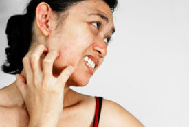 A few common types skin rash that affects people