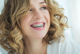 A guide to adult braces