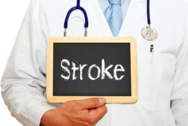 An overview of mini stroke- causes and symptoms explained
