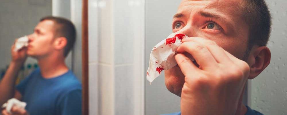 Causes of Nose Bleeding and How to Cure It