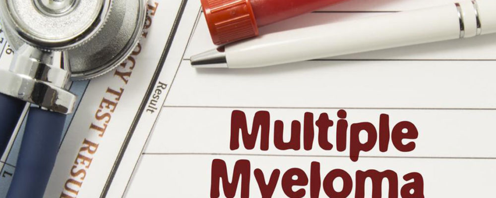 Dealing with multiple myeloma – Things you should know about