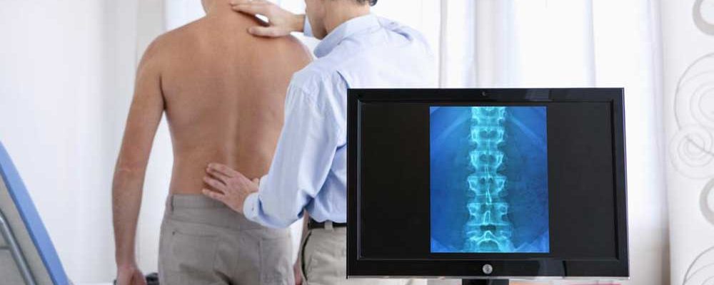 Early Warning Signs of a Spinal Compression Fracture