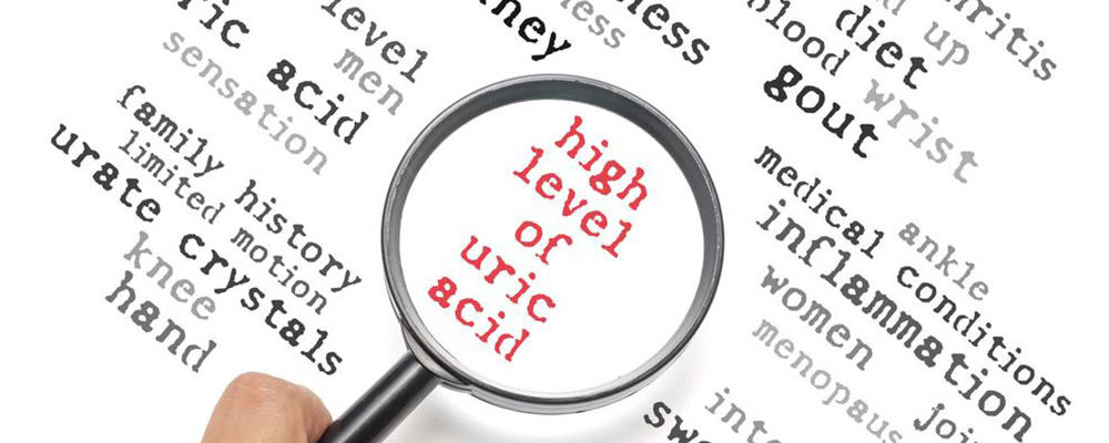 Everything you need to know about high uric acid levels