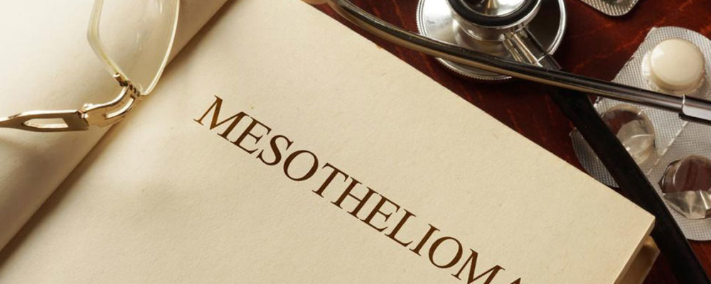 Everything you should know about Mesothelioma