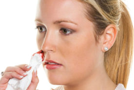 Here are the causes behind nose bleeding