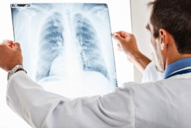Know all about pulmonary embolisms