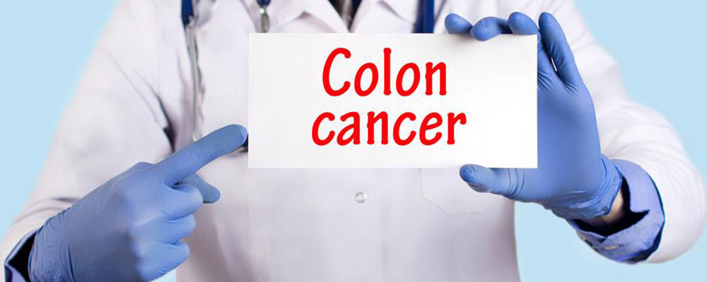Signs and symptoms of colon cancer