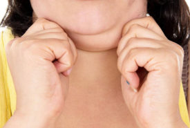 Struggling with a double chin? Here’s how you can get rid of it