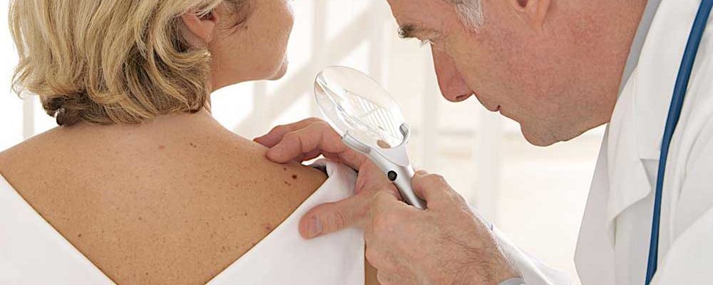 Symptoms and Causes of Squamous Cell Carcinoma