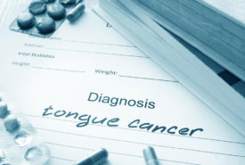 Symptoms of tongue cancer you should not ignore