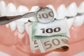 Things to know before buying dentures
