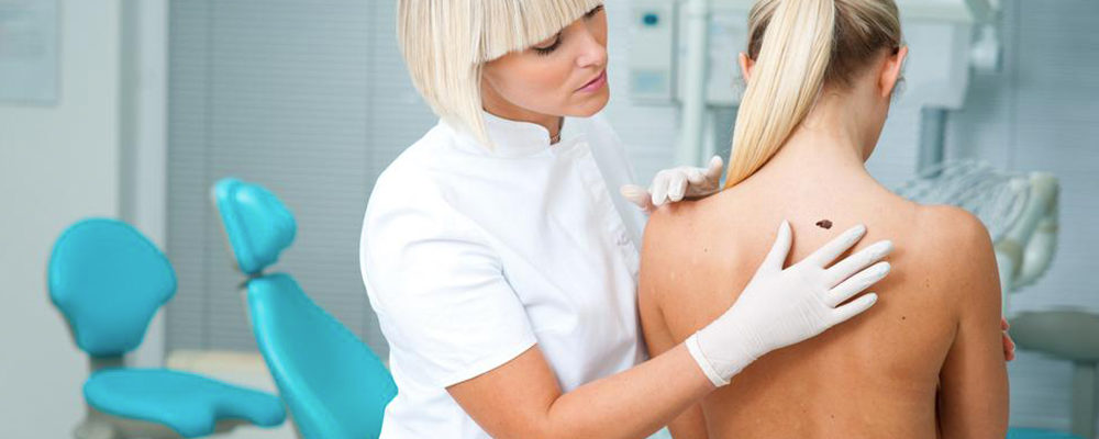 Things you should know about stage four melanoma