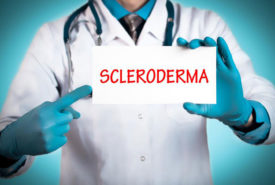 Treating the early symptoms of scleroderma