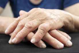 Treatment options and medications for managing rheumatoid arthritis