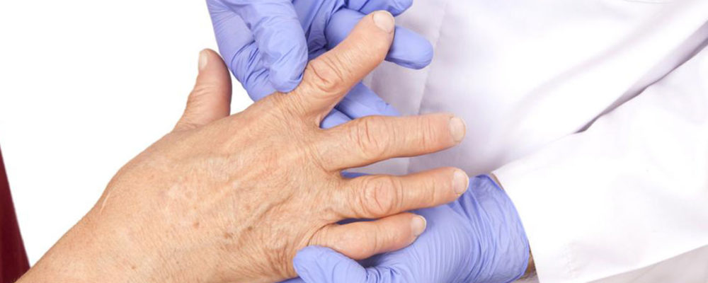 Understanding the various types of arthritis