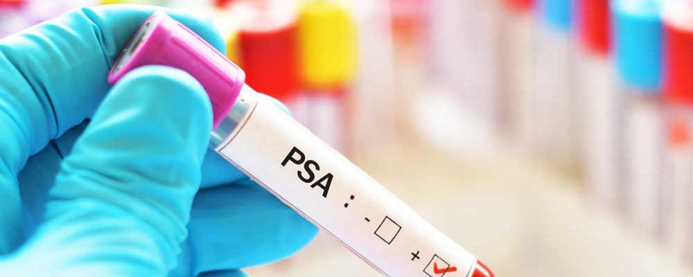 What are the Normal PSA Levels as Per Age