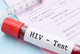 What are the early signs and symptoms of HIV infection?