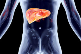 What does stage 4 Hepatitis C mean for your liver