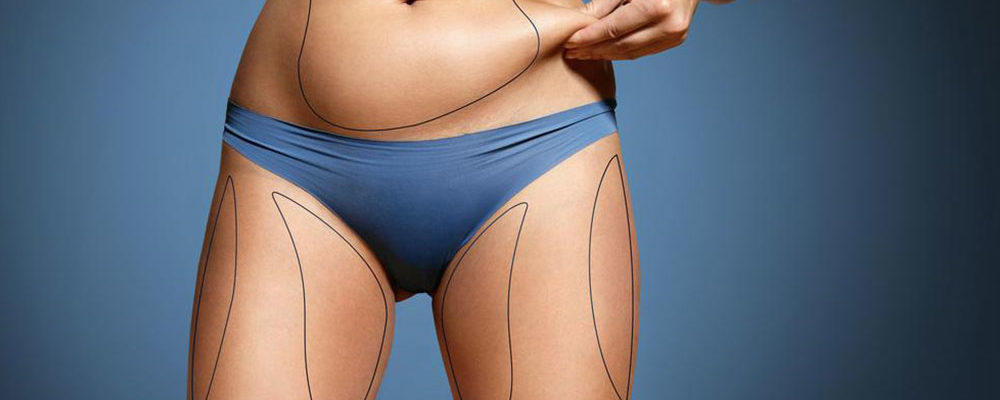 What is coolsculpting fat freezing?