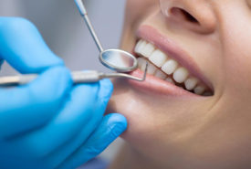 What to expect with dental implants