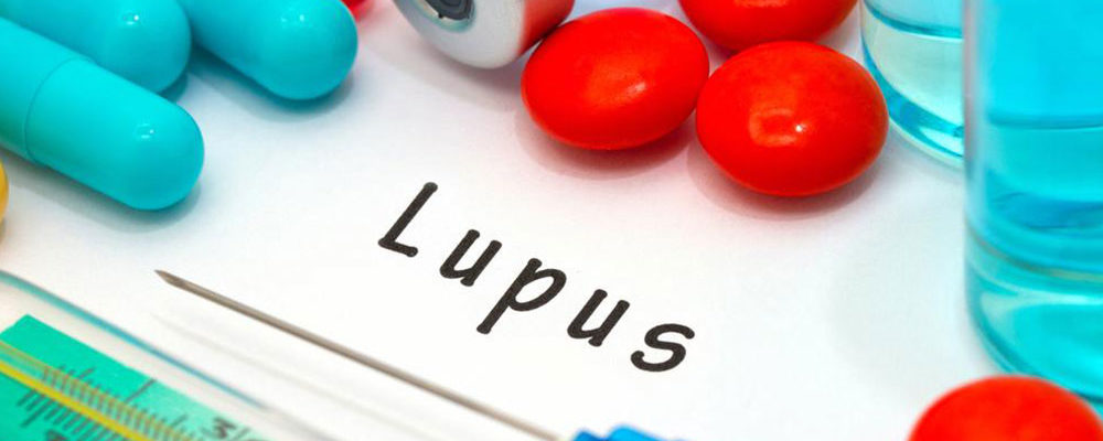 Remedies for Lupus