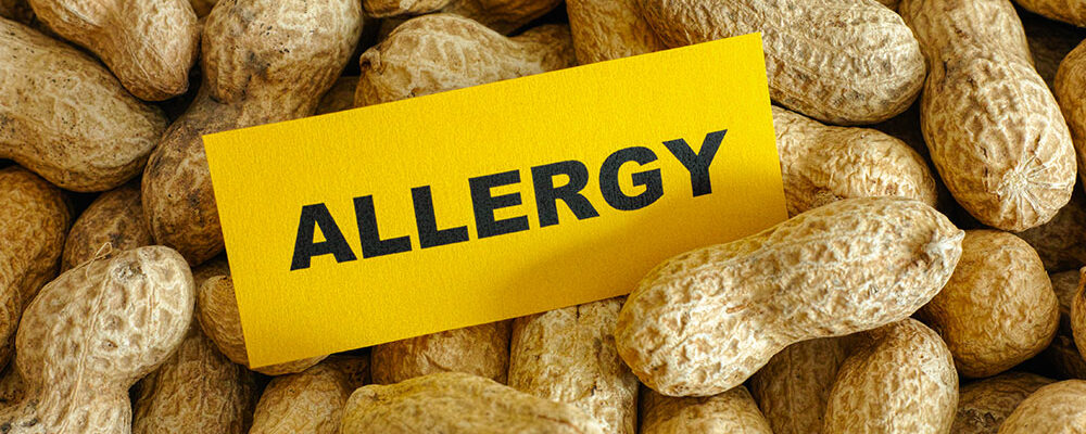 5 most common food allergies