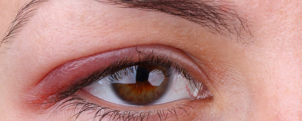 Top 3 conditions that affect eye health